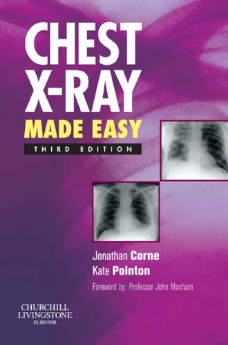 Chest Xray Made Easy 3rd Edition Jonathan Corne Ma Phd Mb Bs Frcp