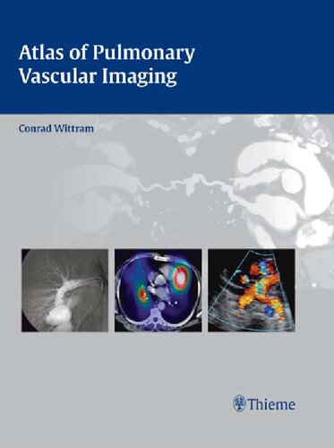 Atlas Of Pulmonary Vascular Imaging A Multimodality Approach 1st Edition Conrad Wittram