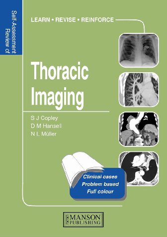 Selfassessment Colour Review Of Thoracic Imaging 1st Edition Sue Copley