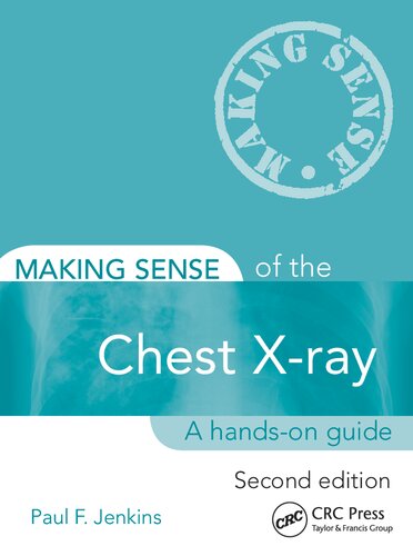 Making Sense Of The Chest Xray A Handson Guide 2nd Edition Paul Jenkins
