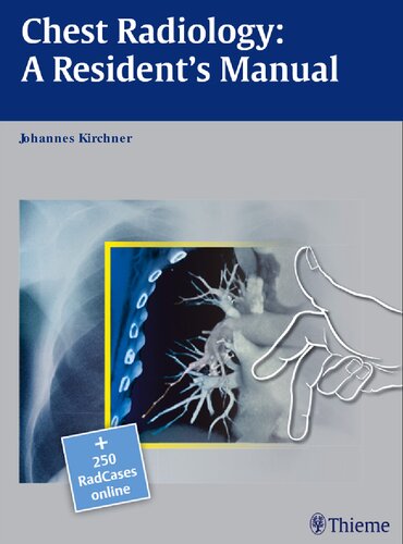 Thieme Chest Radiology A Residents Manual 1st Edition Johannes Kirchner