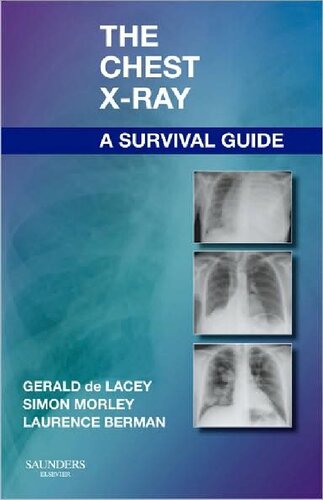 The Chest Xray A Survival Guide 1st Edition Gerald De Lacey Ma Frcr