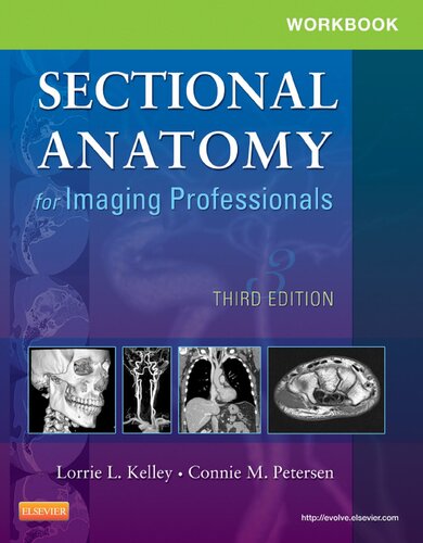 Workbook For Sectional Anatomy For Imaging Professionals 3rd Edition Lorrie L Kelley Ms Rtr