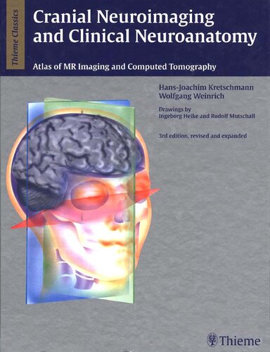 Cranial Neuroimaging And Clinical Neuroanatomy Atlas Of Mr Imaging And Computed Tomography Hansjoachim Kretschmann