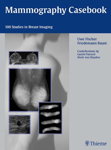 Mammography Casebook 100 Studies In Breast Imaging Uwe Fischer