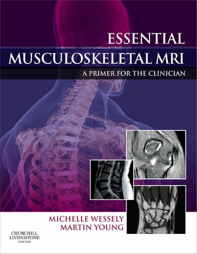 Essential Musculoskeletal Mri A Primer For The Clinician 1st Edition Michelle Anna Wessely Bsc Chiropractic Dc