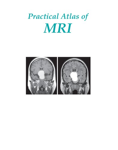 Practical Atlas Of Mri 1st Edition Jagan Mohan Reddy