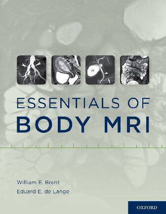 Essentials Of Body Mri Illustrated William E Brant Editor