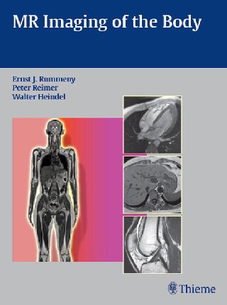 Mr Imaging Of The Body Illustrated Ernst Rummeny Editor