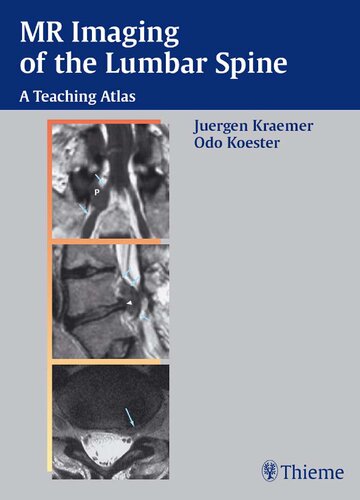 Mrimaging Of The Lumbar Spine 1st Edition Jrgen Krmer Odo Kster