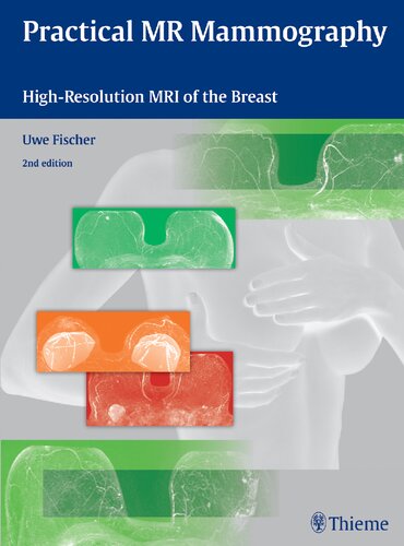 Practical Mr Mammography Highresolution Mri Of The Breast 2nd Edition Uwe Fischer