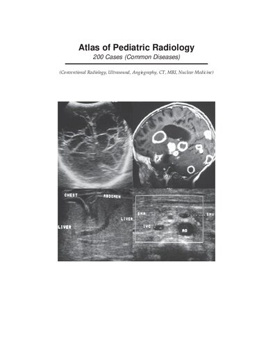 Atlas Of Pediatric Radiology 200 Cases Common Diseases First Haouimi