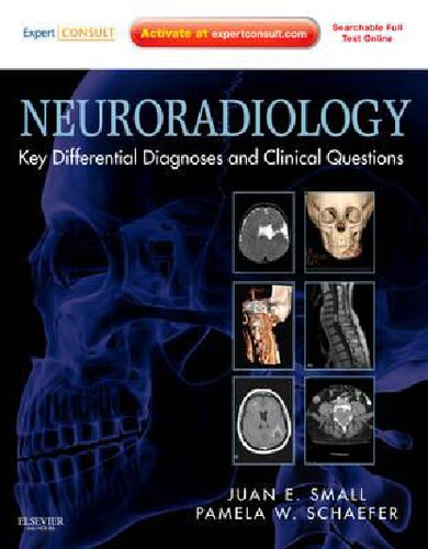 Neuroradiology Key Differential Diagnoses And Clinical Questions Expert Consult Online And Print 1st Edition Juan Small