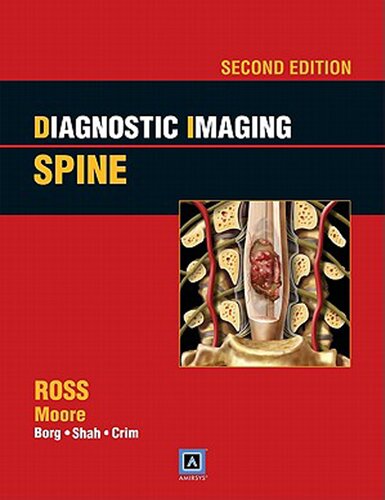 Diagnostic Imaging Spine 2nd Edition Jeffrey S Ross Md Moore