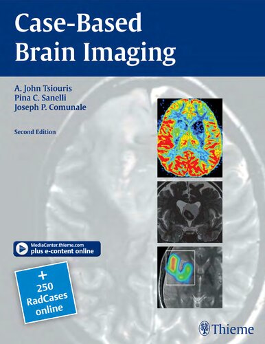 Casebased Brain Imaging 2nd Edition Apostolos John Tsiouris