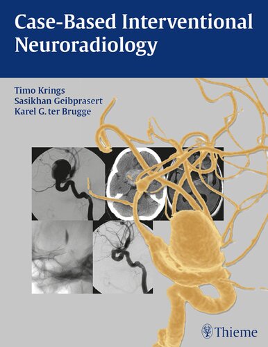 Casebased Interventional Neuroradiology 1st Edition Timo Krings
