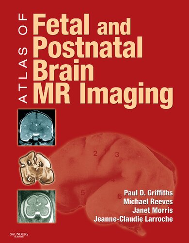 Atlas Of Fetal And Postnatal Brain Mr 1st Edition Paul Griffiths