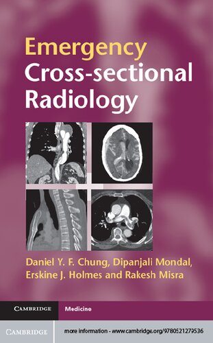 Emergency Crosssectional Radiology Cambridge Medicine Paperback Illustrated Daniel Y F Chung