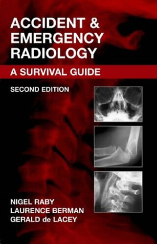 Accident Emergency Radiology 2nd Edition Nigel Raby Laurence Berman