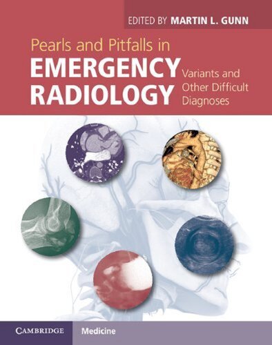 Pearls And Pitfalls In Emergency Radiology Variants And Other Difficult Diagnoses Illustrated Martin L Gunn Editor