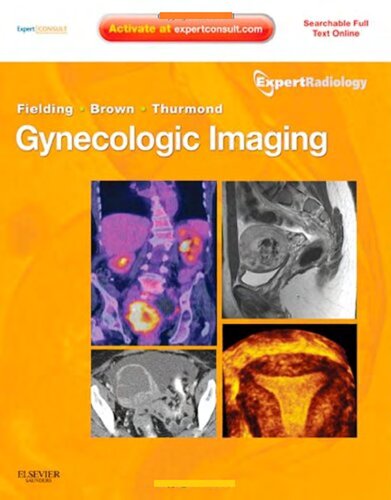 Gynecologic Imaging 1st Edition Julia R Fielding Douglas L Brown