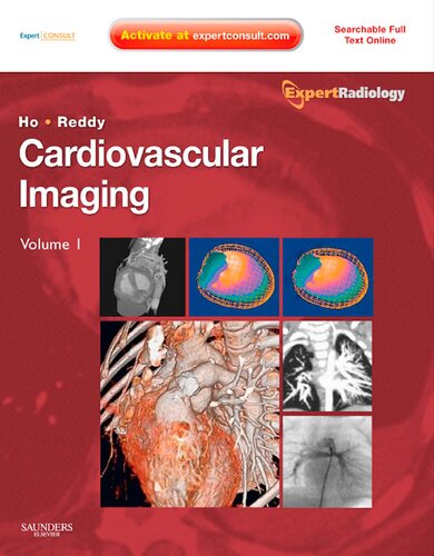 Cardiovascular Imaging Two Volume Set 1st Edition Vincent B Ho