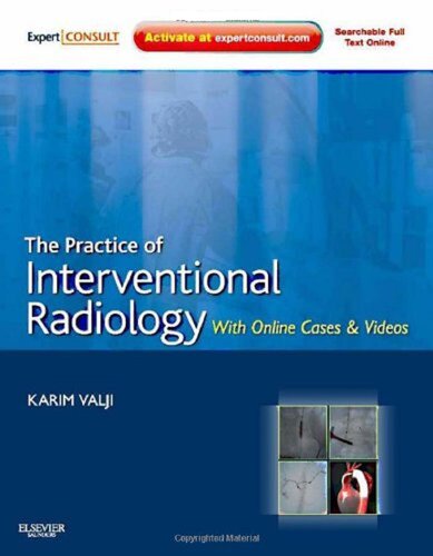 The Practice Of Interventional Radiology With Online Cases And Video Expert Consult Premium Edition Enhanced Online Features And Print 1e Expert Consult Title Online Print 1st Edition Karim Valji Md
