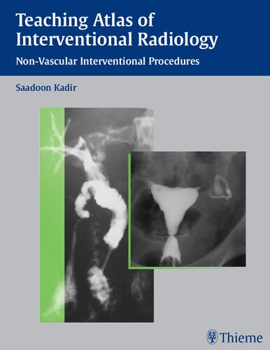 Teaching Atlas Of Interventional Radiology 1st Edition Saadoon Kadir