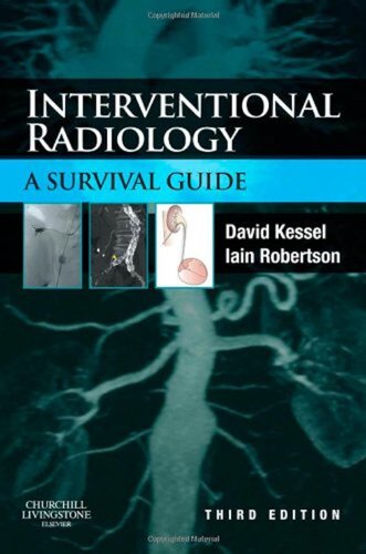 Interventional Radiology A Survival Guide 3rd Edition David Kessel