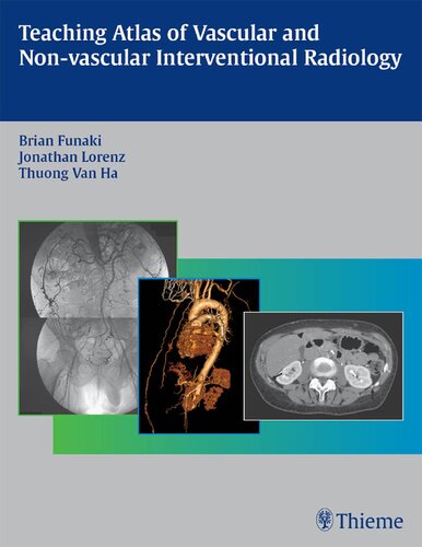 Teaching Atlas Of Vascular And Nonvascular Interventional Radiology 1st Edition Brian Funaki