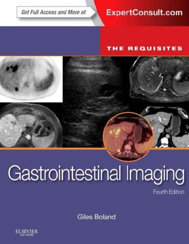 Gastrointestinal Imaging The Requisites 4e Requisites In Radiology 4th Edition Giles W Boland Md Facr