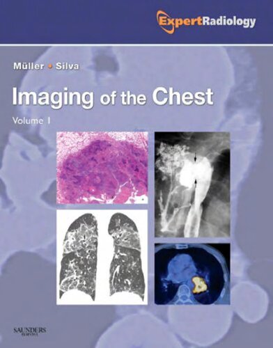 Imaging Of The Chest 2volume Set Expert Radiology Series 1e 1st Edition Nestor L Muller