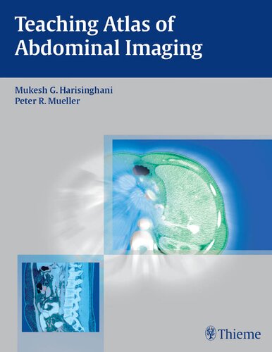 Teaching Atlas Of Abdominal Imaging 1st Edition Mukesh Harisinghani