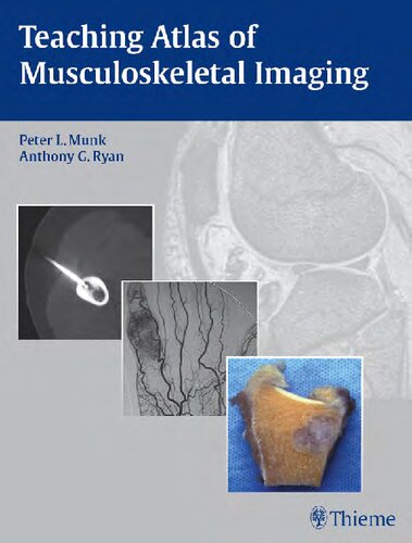 Teaching Atlas Of Musculoskeletal Imaging 1st Edition Peter Munk