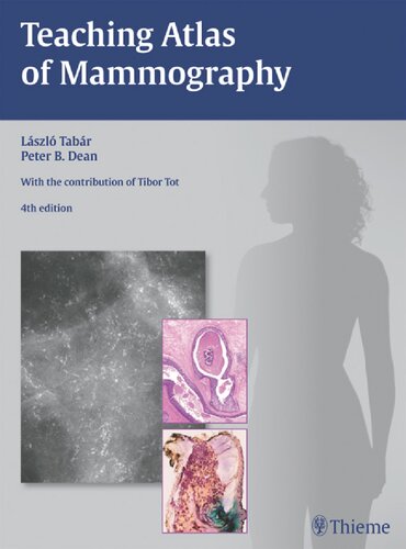 Teaching Atlas Of Mammography 4th Edition Laszlo Tabar