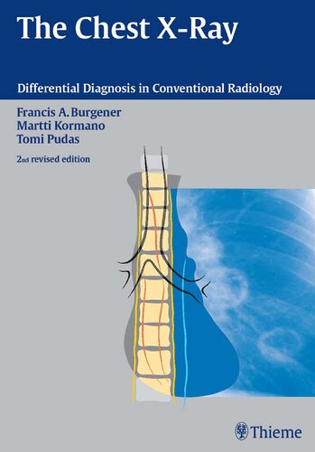 The Chest Xray 2nd Revised Francis A Burgener Martti Kormano