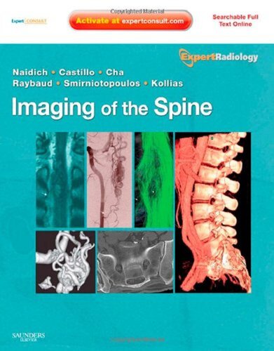 Imaging Of The Spine Expert Radiology Series Expert Consultonline And Print 1st Edition Thomas P Naidich