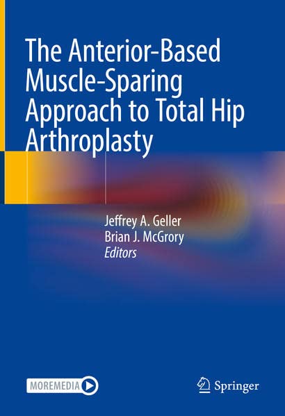The Anteriorbased Musclesparing Approach To Total Hip Arthroplasty 1st Ed 2022 Jeffrey A Geller