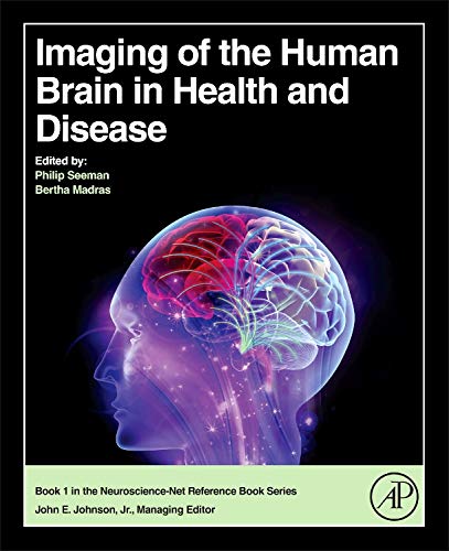 Imaging Of The Human Brain In Health And Disease 1st Edition Philip Seeman