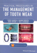 Practical Procedures In The Management Of Tooth Wear Subir Banerji