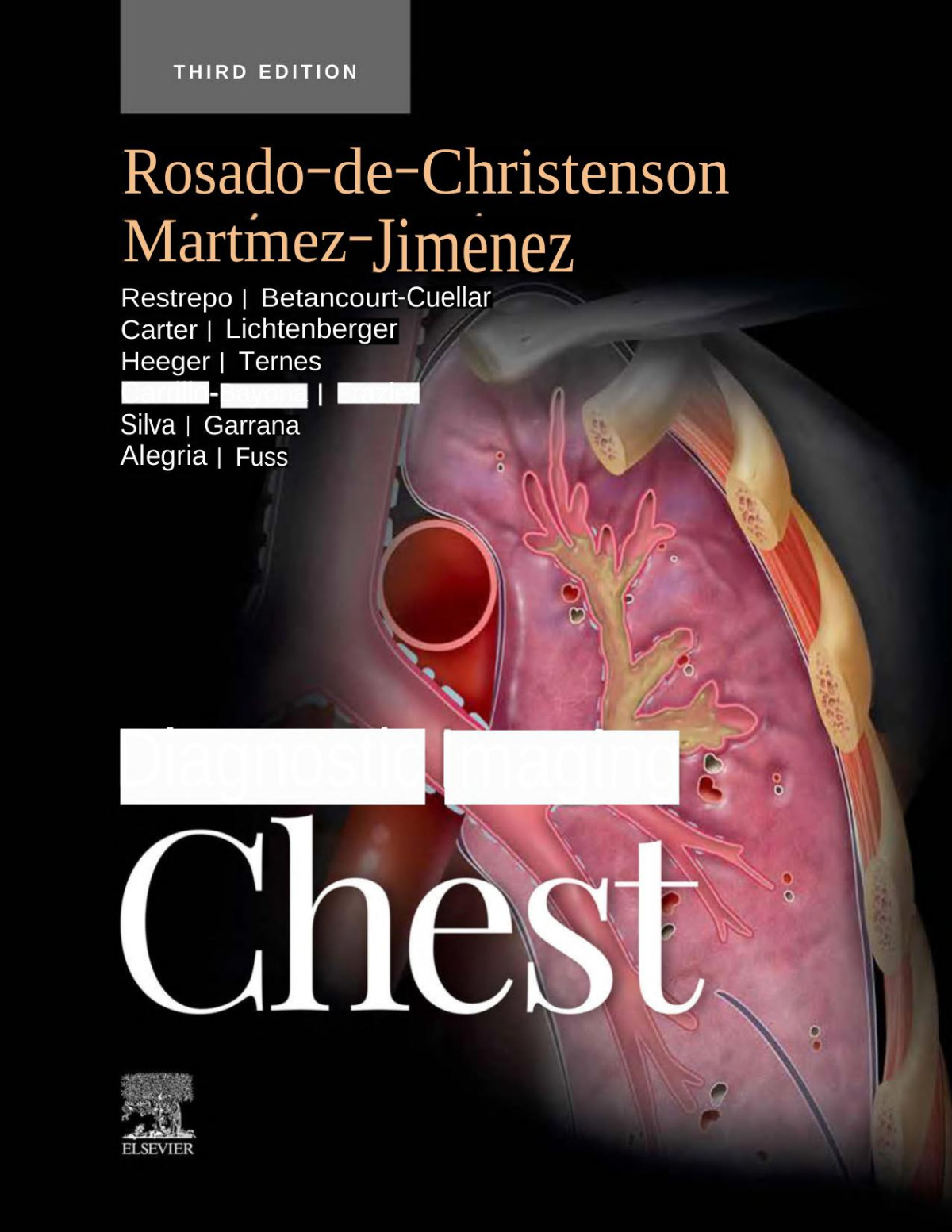 Diagnostic Imaging Chest Melissa L Rosadodechristenson Md Facr Santiago Martnezjimnez