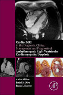 The Cardiac Mri In Diagnosis Clinical Management And Prognosis Of Arrhythmogenic Right Ventricular Cardiomyopathydysplasia Aiden Abidov Isabel Oliva Frank I Marcus
