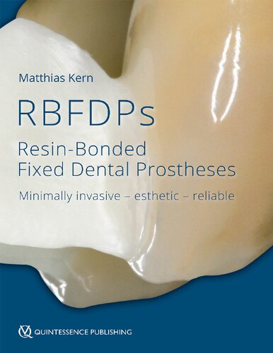 Resinbonded Fixed Dental Prostheses 1st Edition Matthias Kern