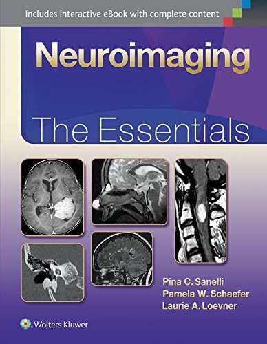 Neuroimaging The Essentials Essentials Series 1st Edition Pina Sanelli