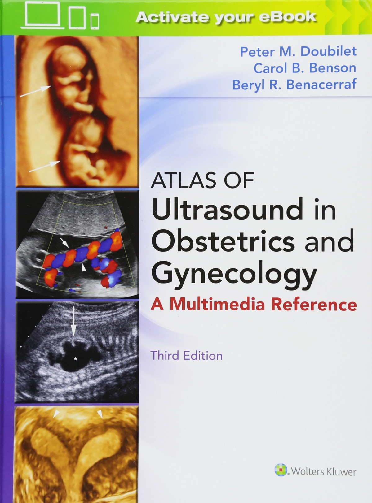 Atlas Of Ultrasound In Obstetrics And Gynecology 3rd Edition Peter M Doubilet Md Phd