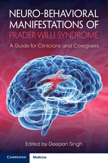 Neurobehavioral Manifestations Of Praderwilli Syndrome Deepan Singh