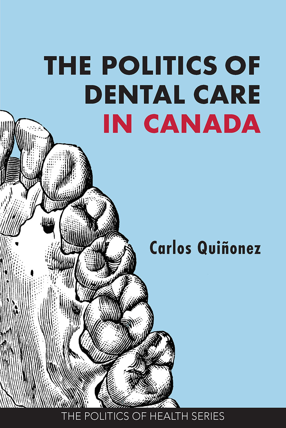 The Politics Of Dental Care In Canada Carlos Quionez
