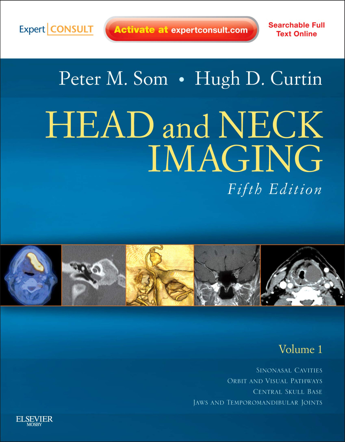 Head And Neck Imaging 2 Volume Set 5th Edition Peter M Som