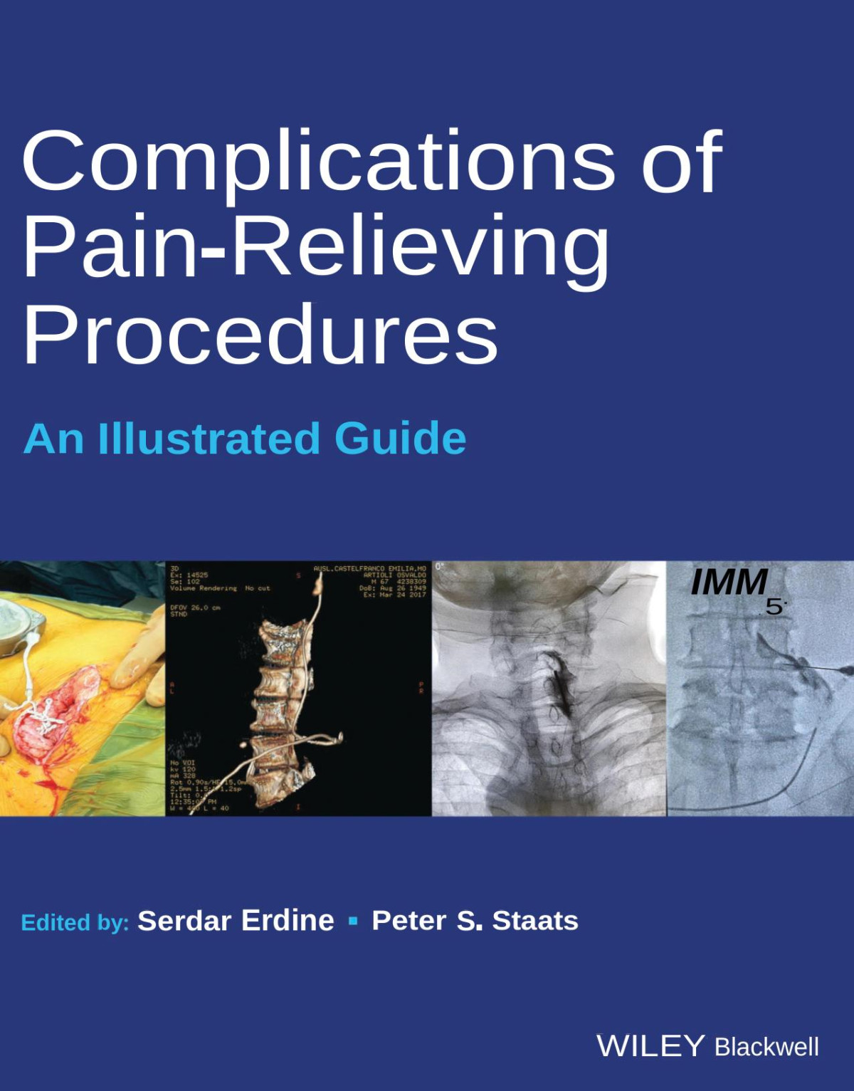 Complications Of Painrelieving Procedures Serdar Erdine Peter Staats