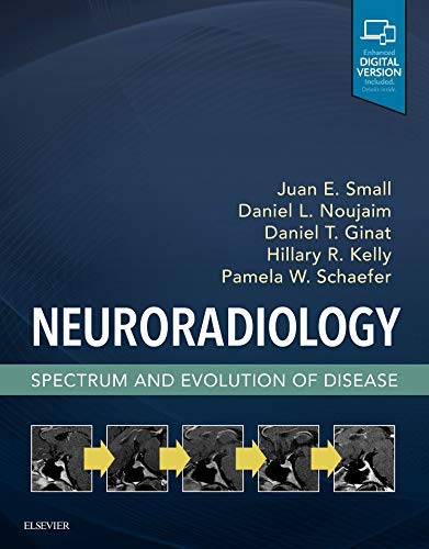 Neuroradiology Spectrum And Evolution Of Disease 1st Edition Juan Small Md Msc